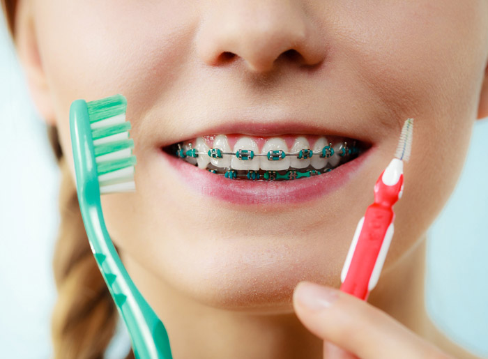 Oral Hygiene With Braces Dr. Thomas Montemurno Orthodontics